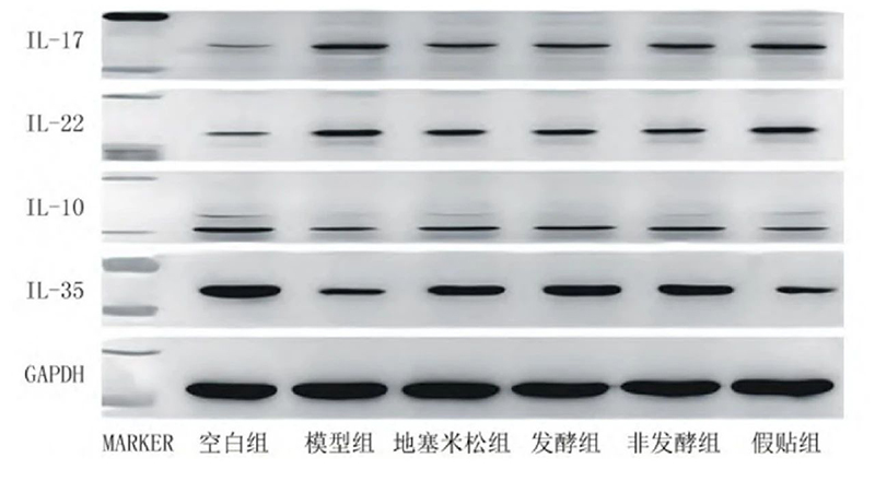 空白組和支氣管哮喘各組大鼠肺組織中IL－17、IL－22、IL－10、IL－35蛋白表達電泳圖